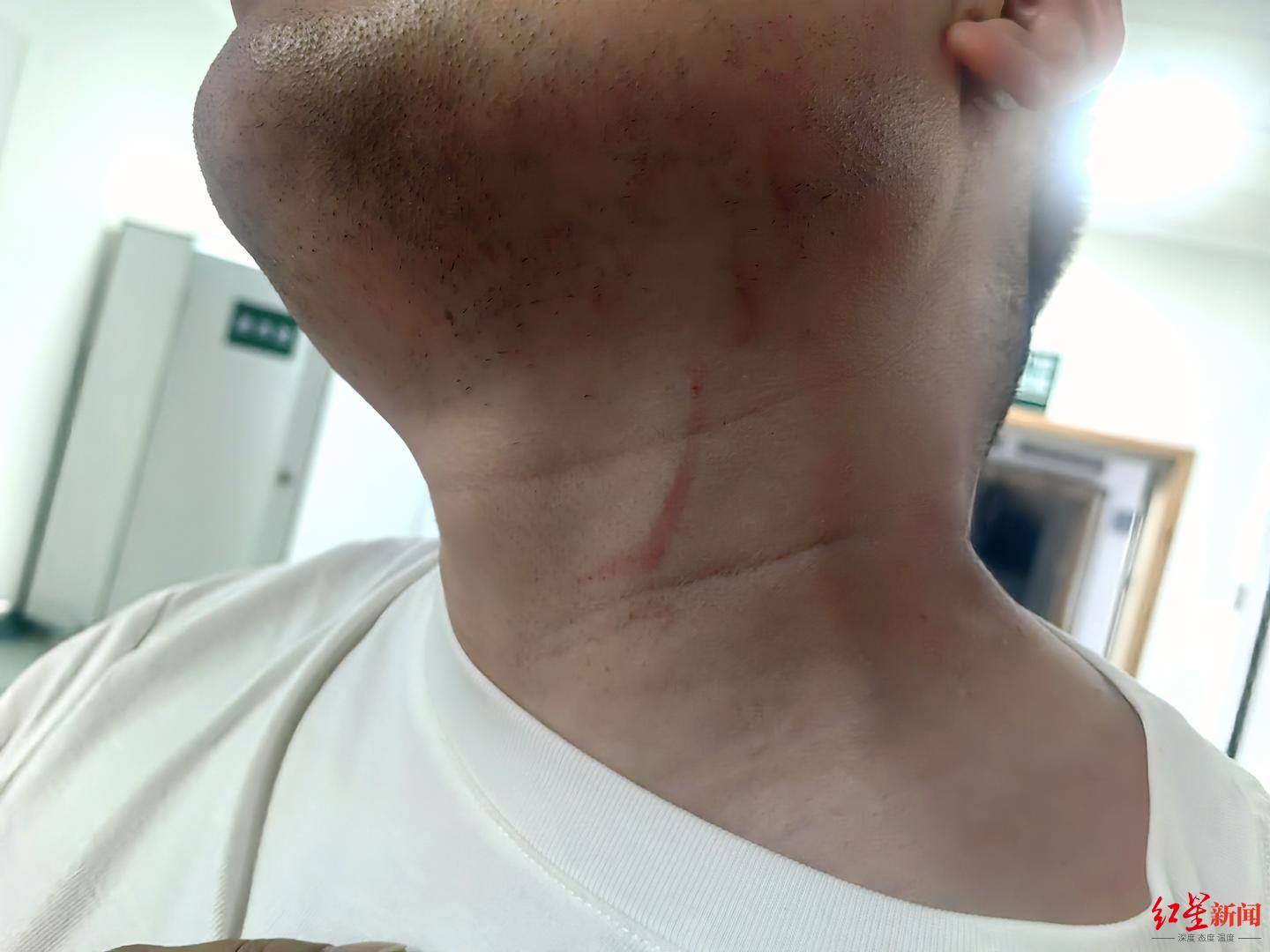 皇冠信用网如何注册_武汉男子拍摄违停时被当街殴打皇冠信用网如何注册，打人者被罚款500元，被打者称将提起行政复议并起诉